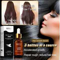 Snail Care Hair Loss Growth Essence Liquid Hair Thickening