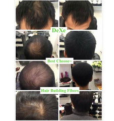 Hair Care Hair Loss Treatments